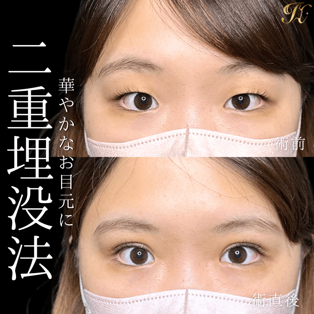 症例イメージ