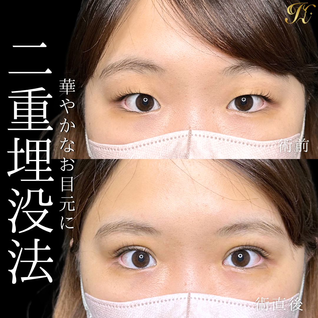 症例イメージ