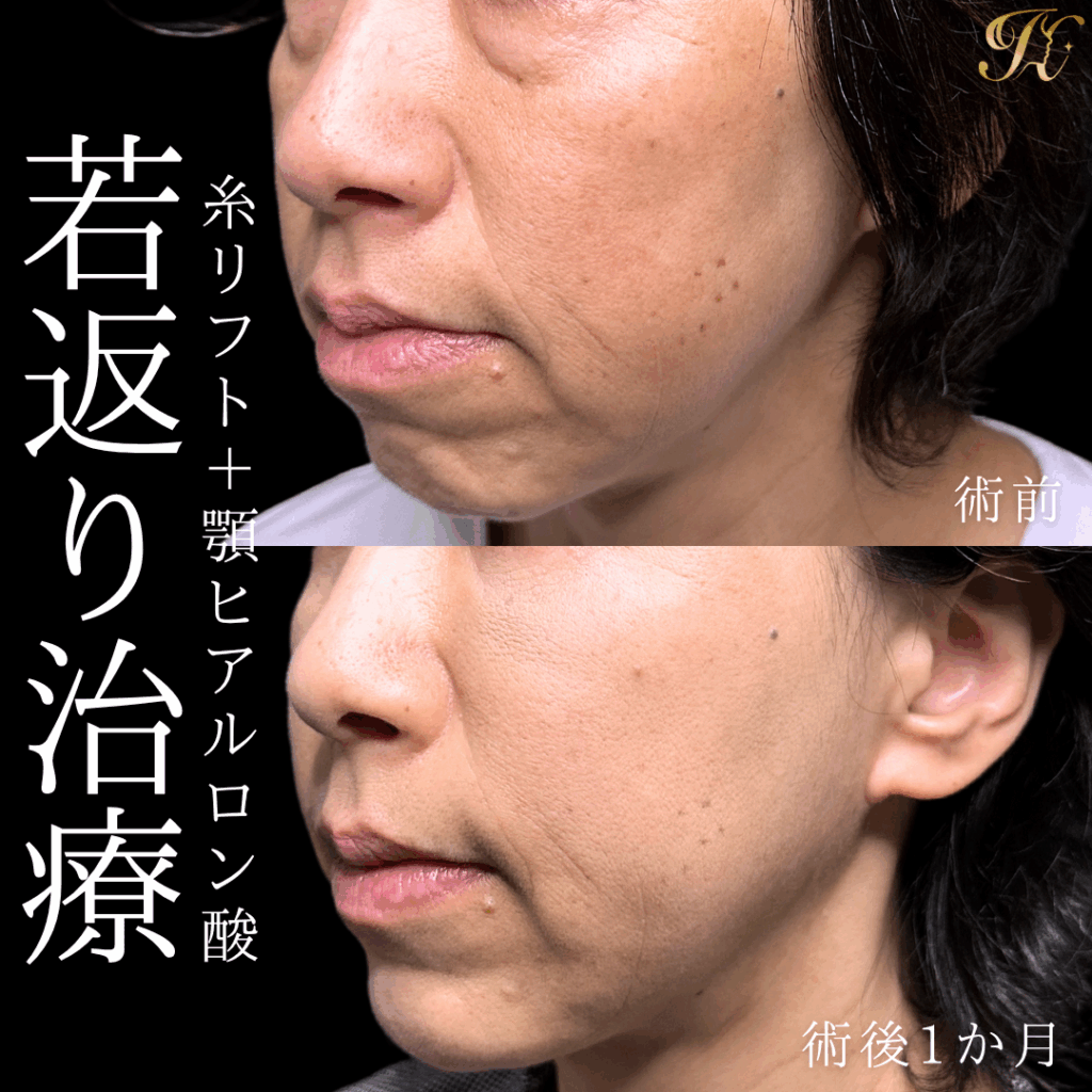症例イメージ