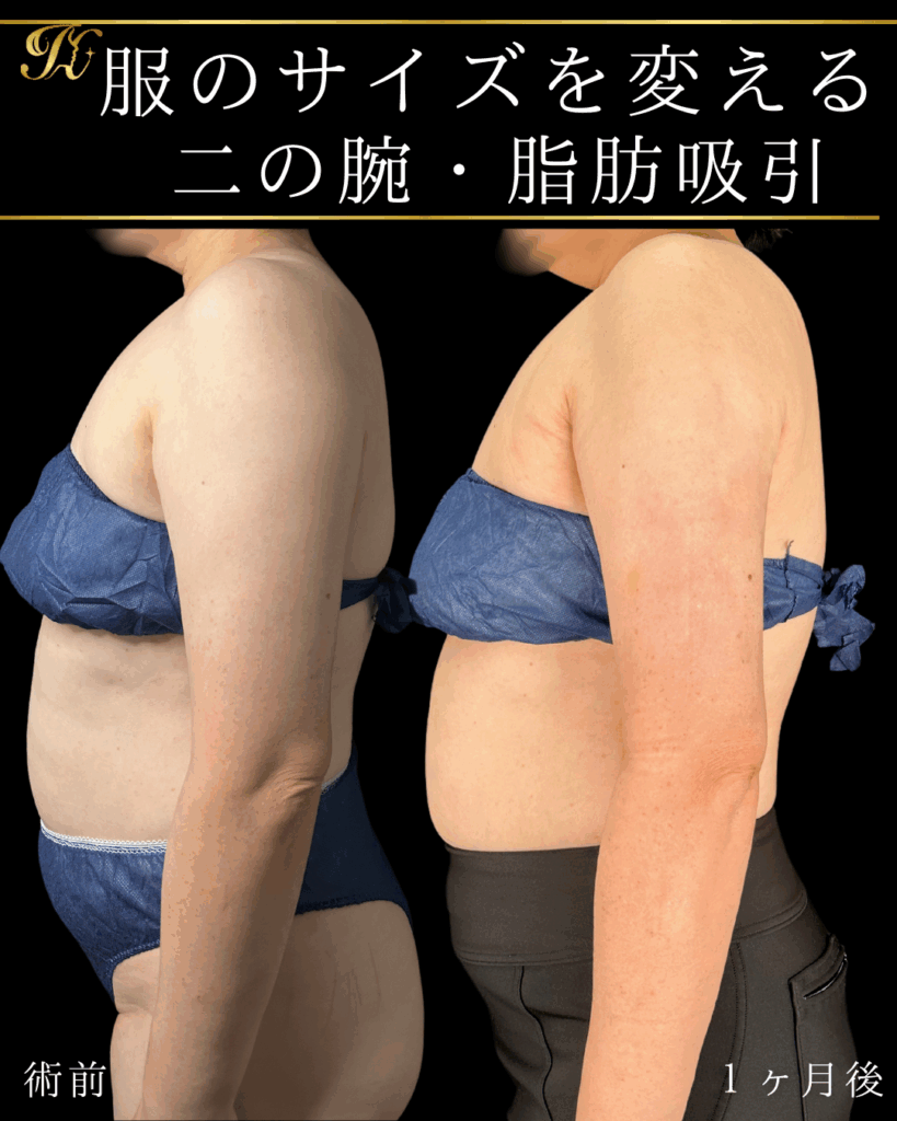 症例イメージ