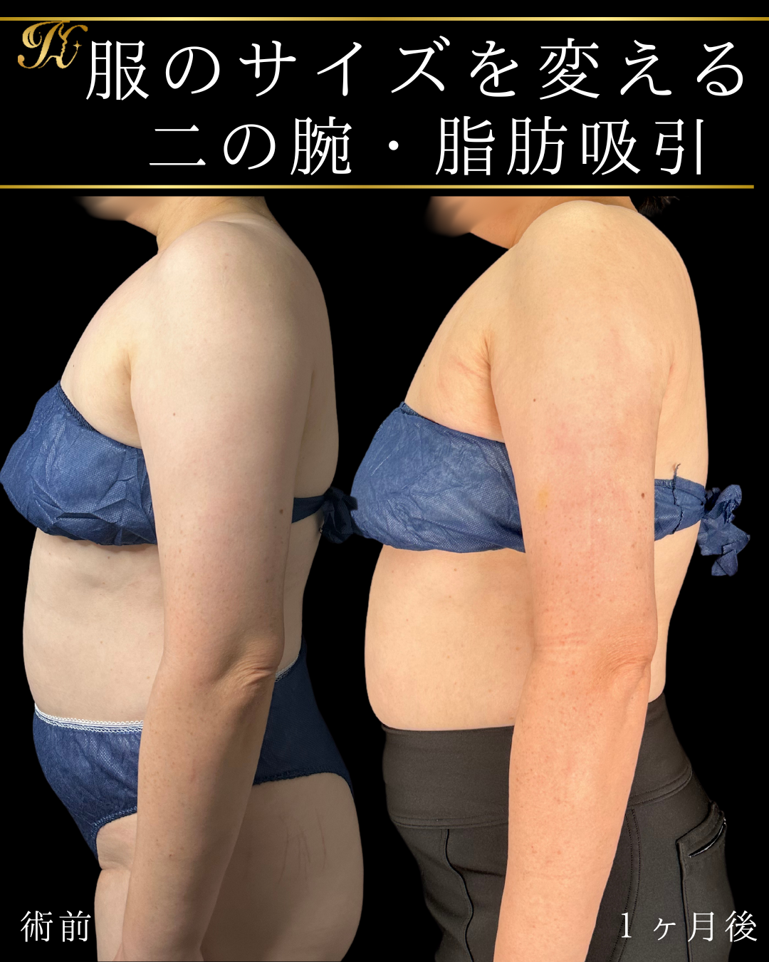 症例イメージ