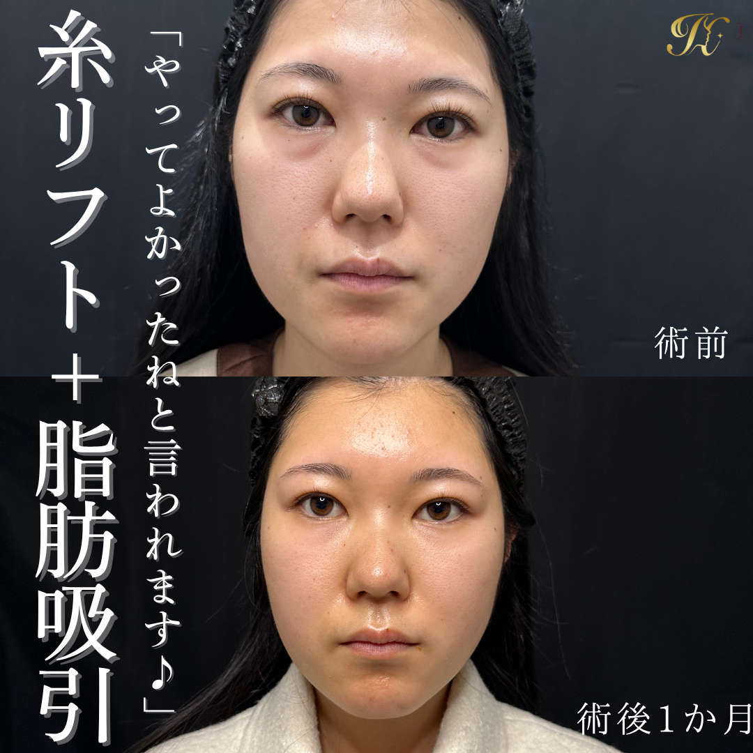 症例イメージ