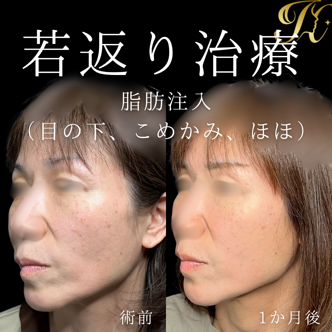 症例イメージ