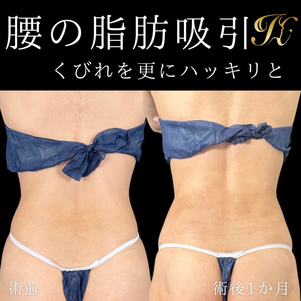症例イメージ