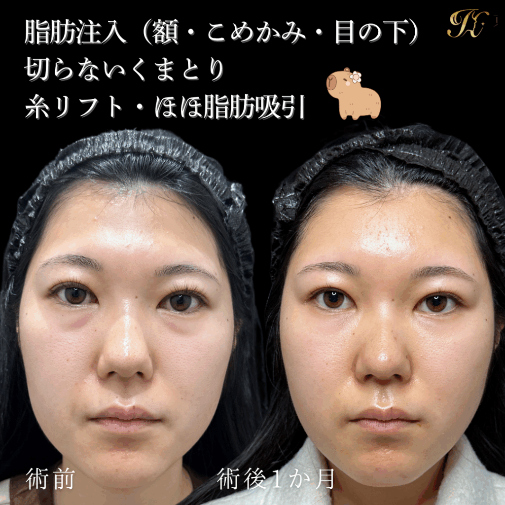 症例イメージ