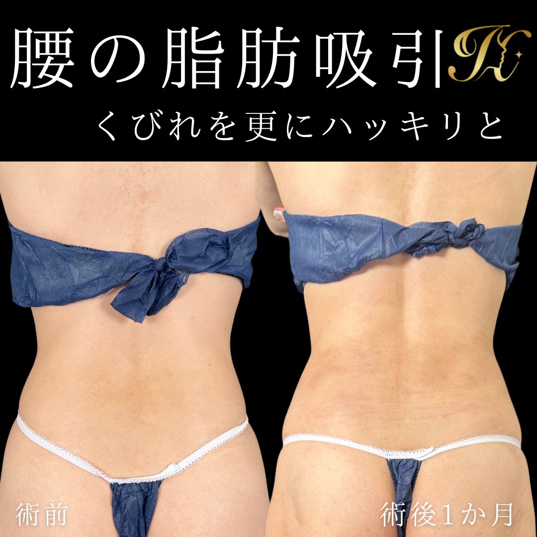 症例イメージ