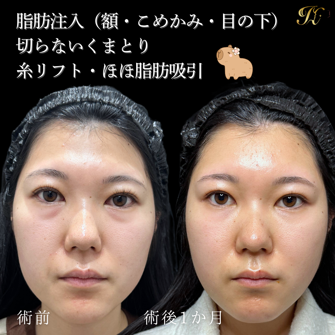 症例イメージ