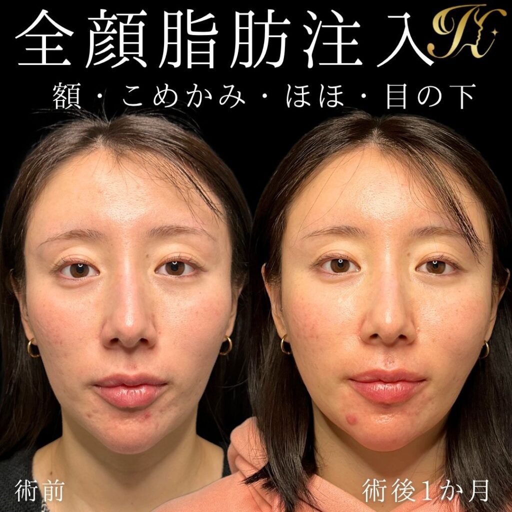 症例イメージ