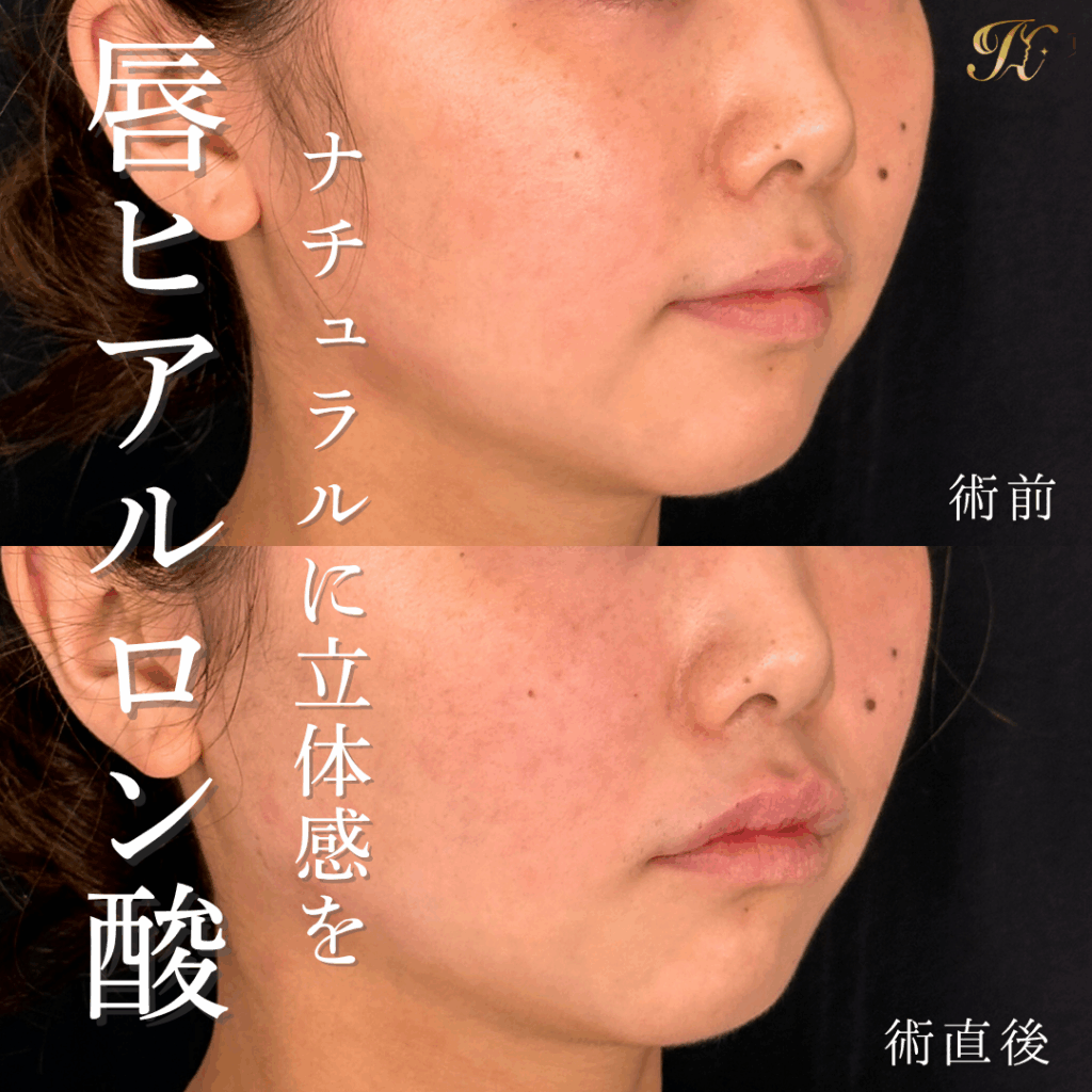 症例イメージ