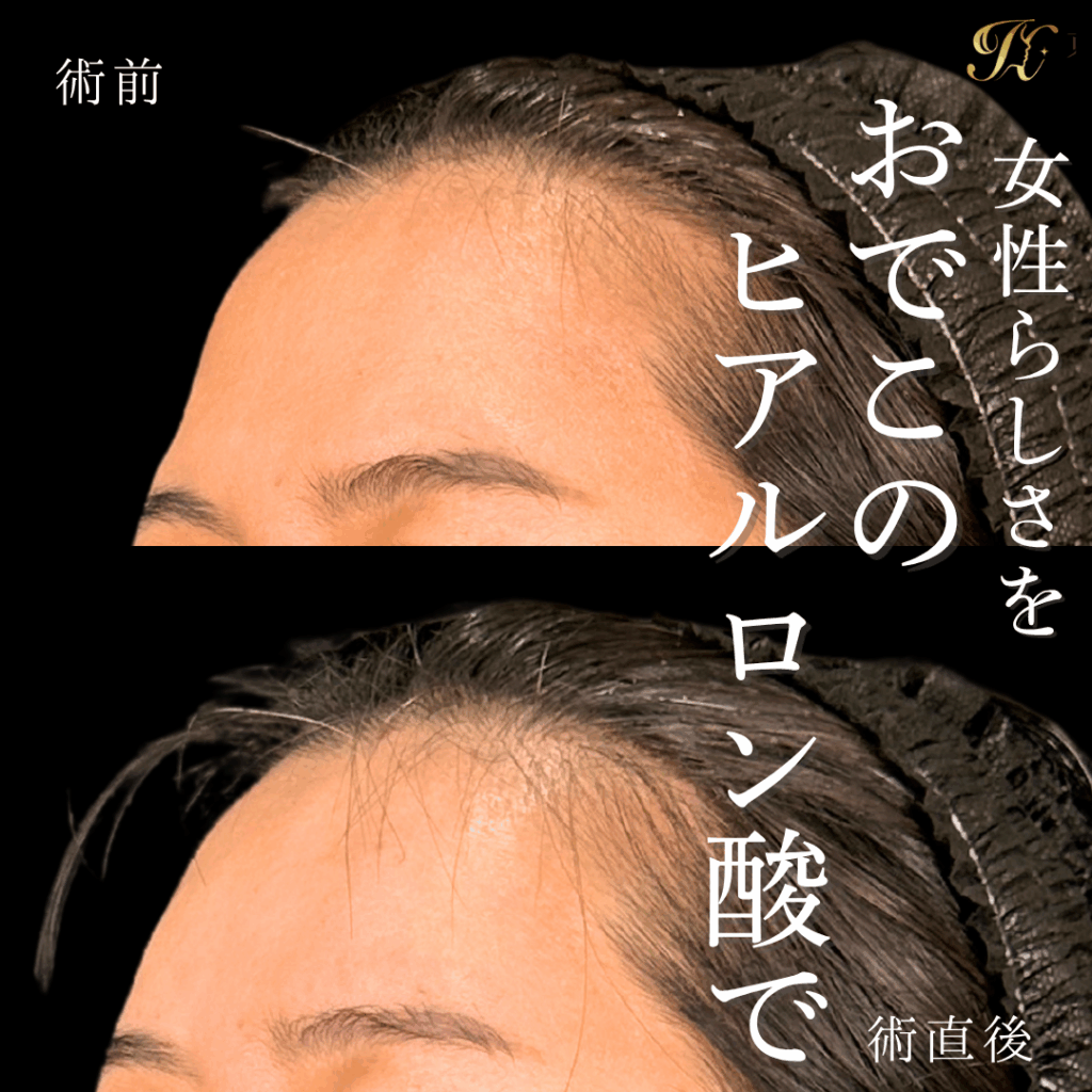 症例イメージ
