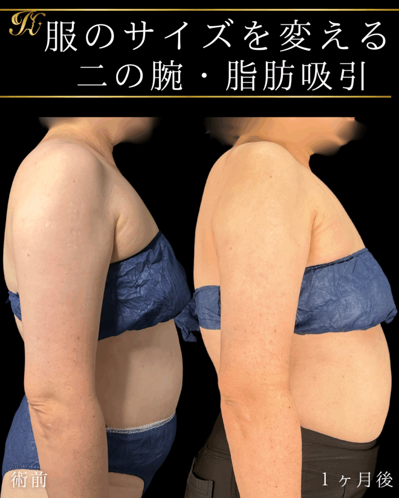 症例イメージ