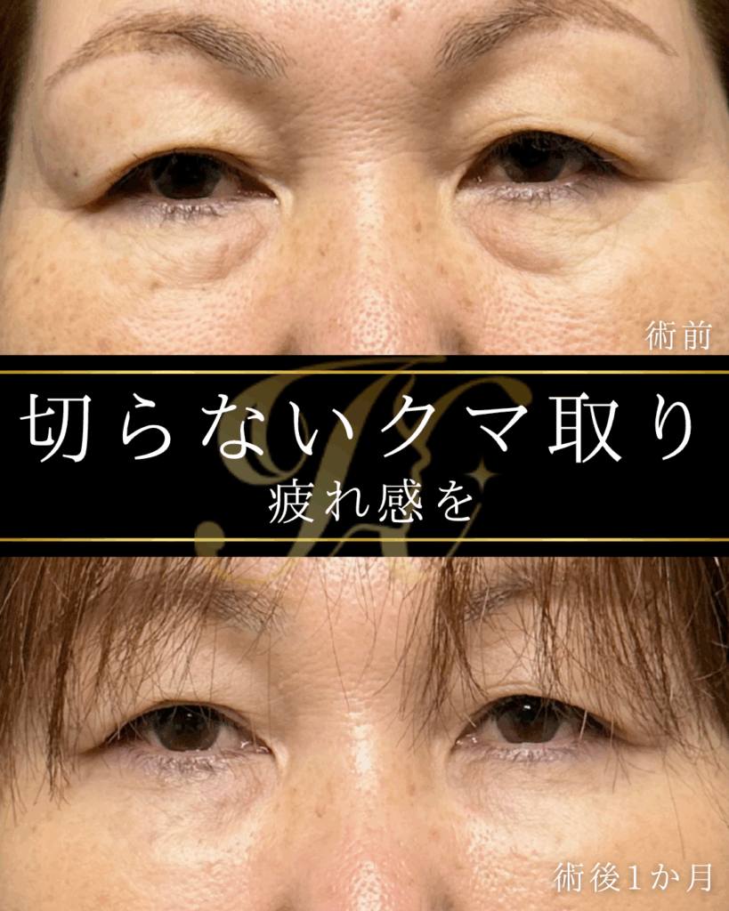 症例イメージ