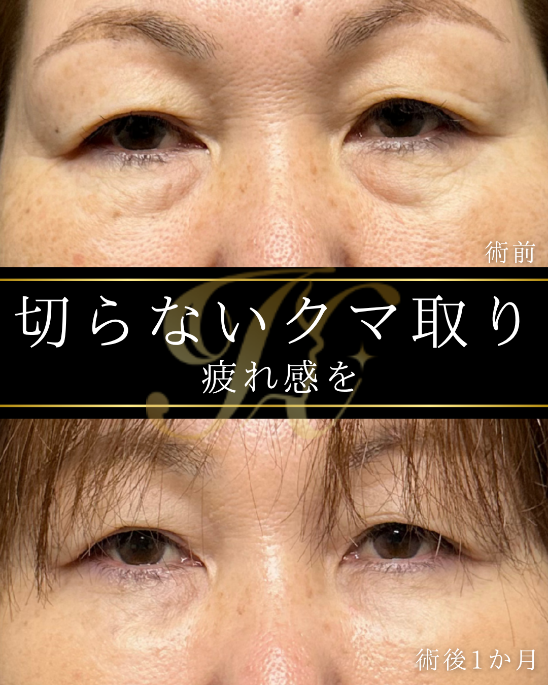 症例イメージ