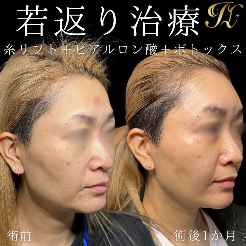 症例イメージ