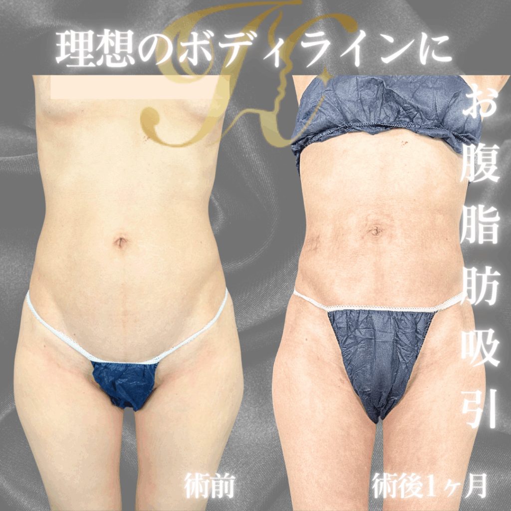 症例イメージ
