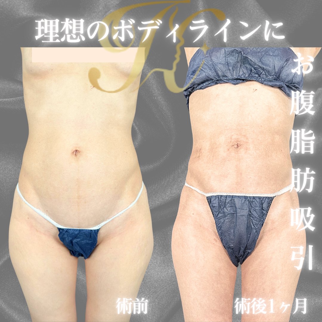 症例イメージ