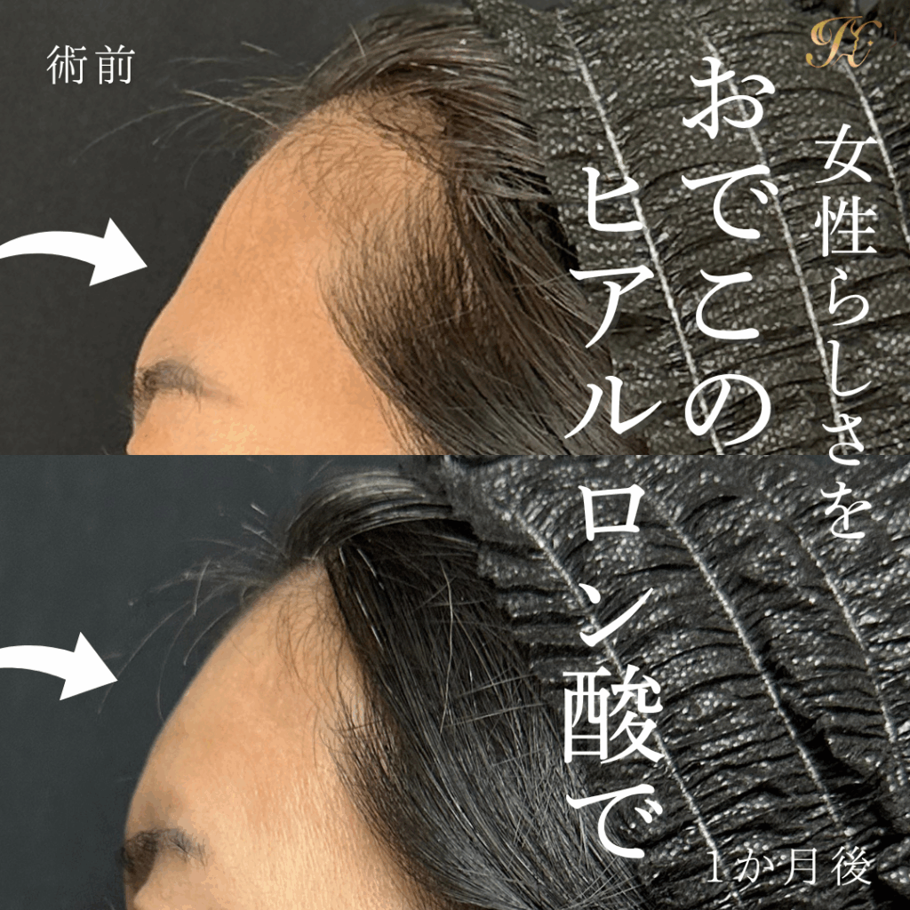 症例イメージ