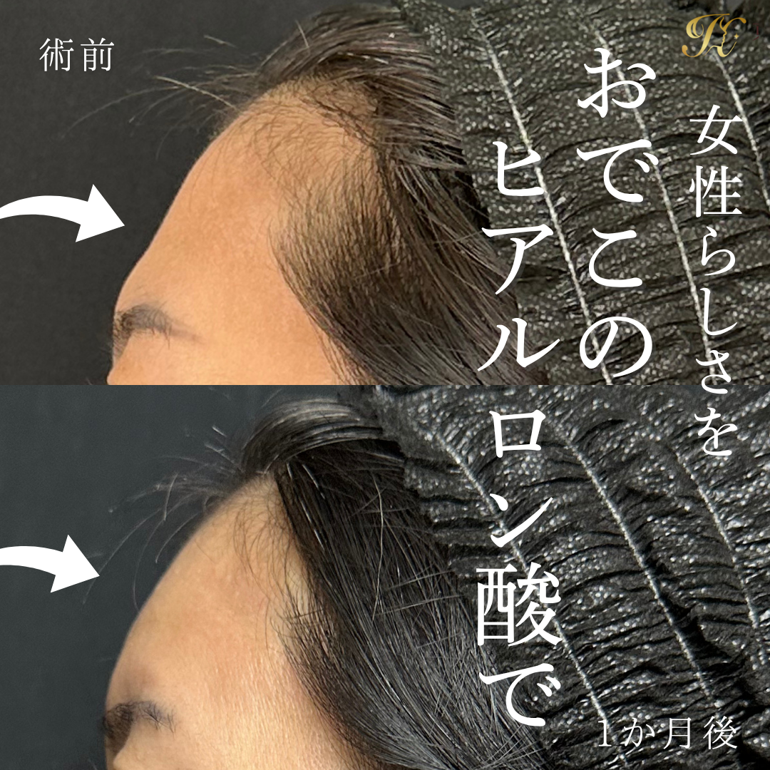 症例イメージ