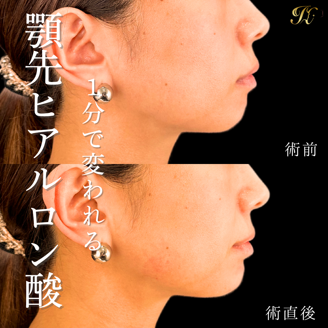 症例イメージ