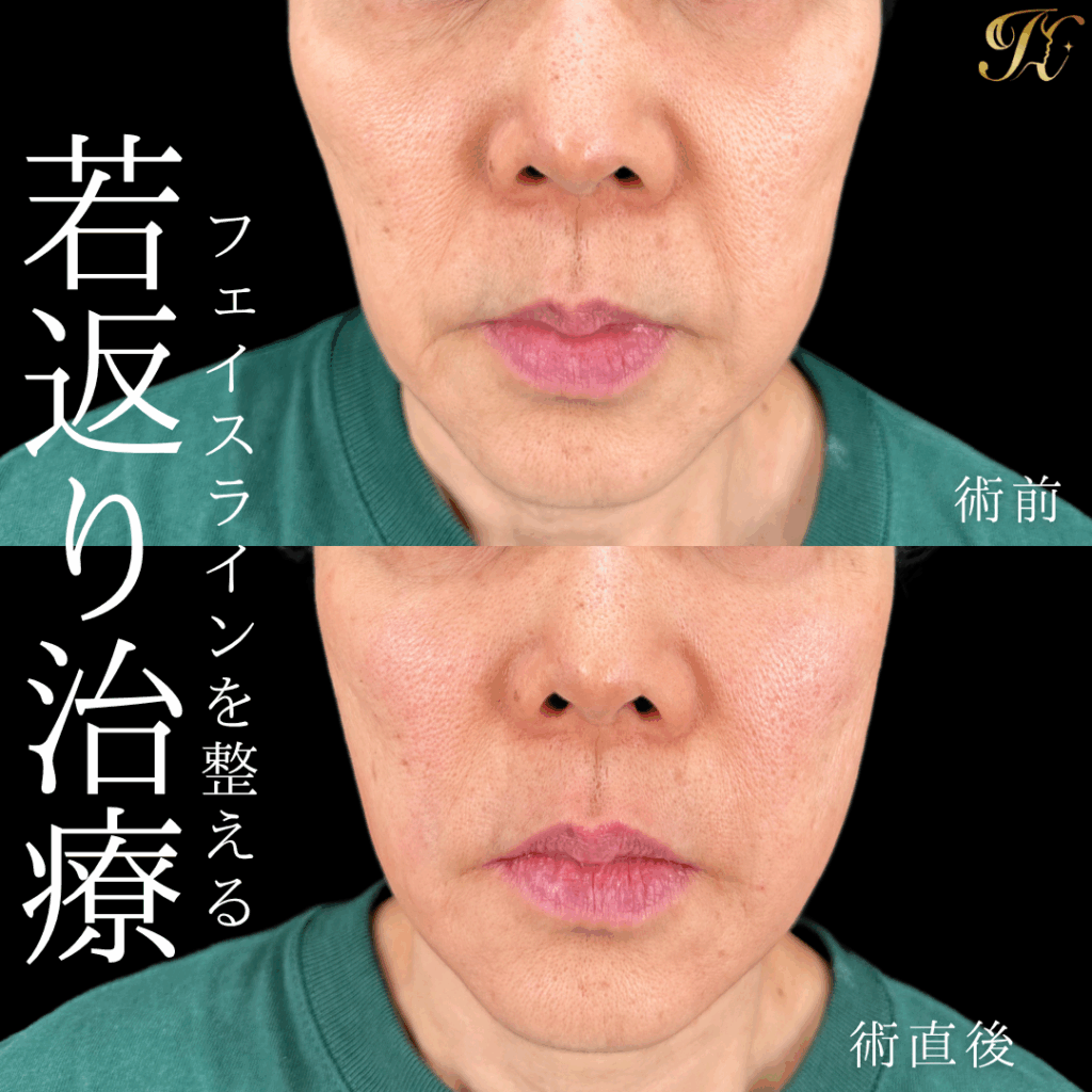 症例イメージ