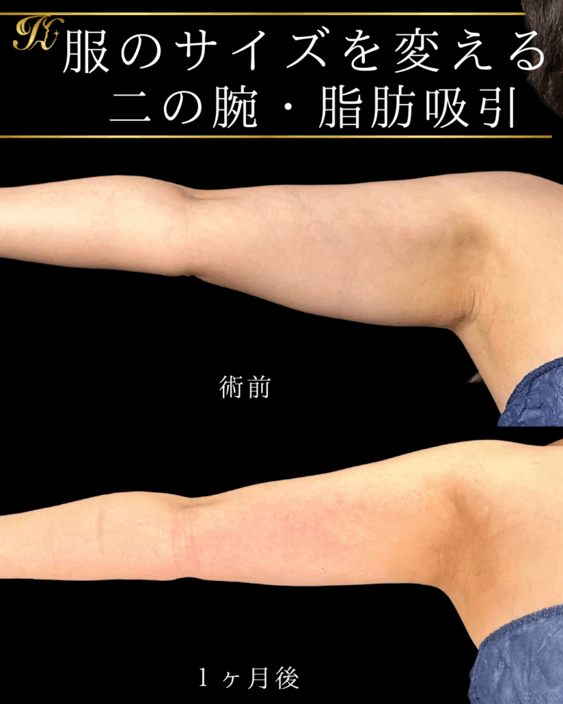 症例イメージ