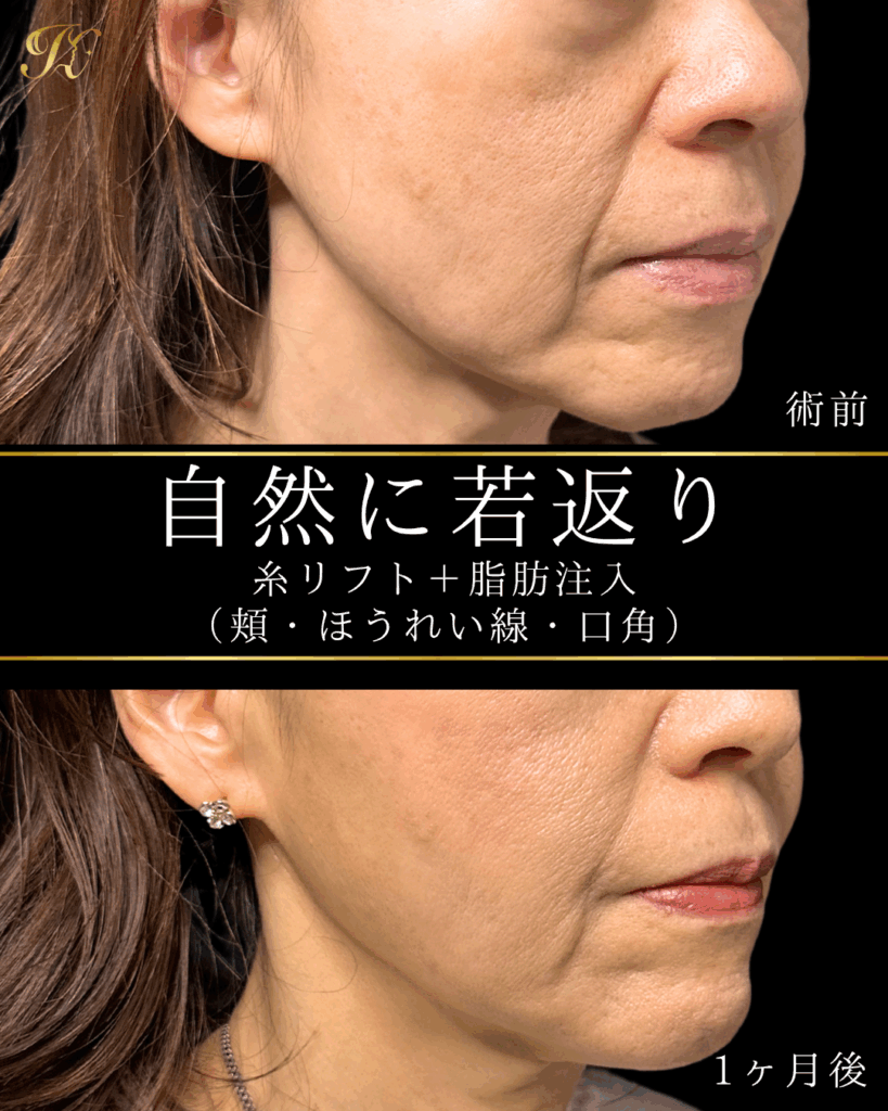 症例イメージ