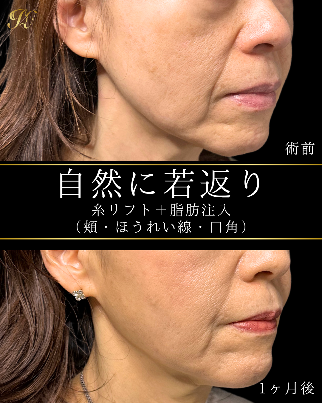 症例イメージ
