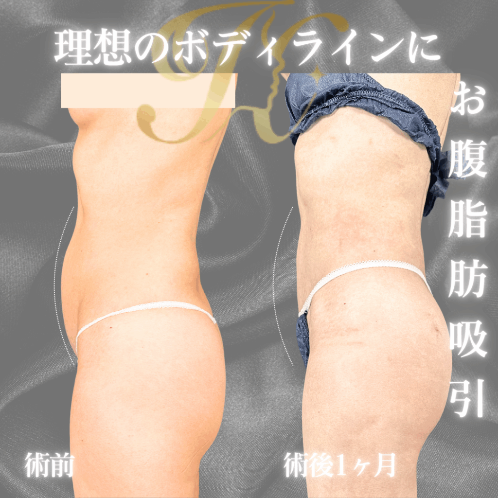 症例イメージ