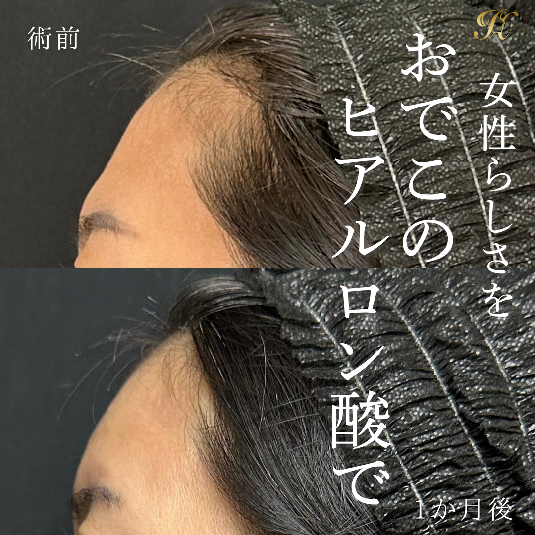 症例イメージ