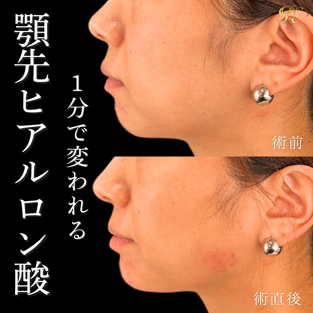 症例イメージ