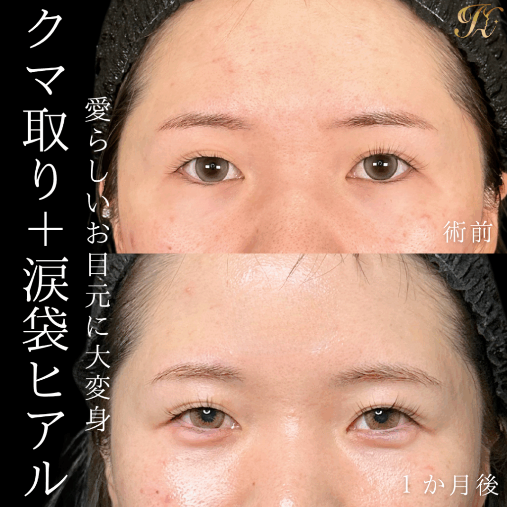 症例イメージ