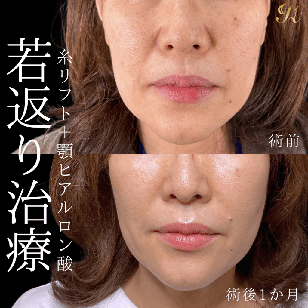 症例イメージ