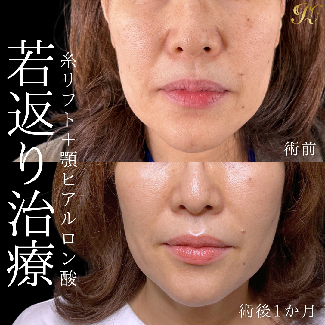 症例イメージ