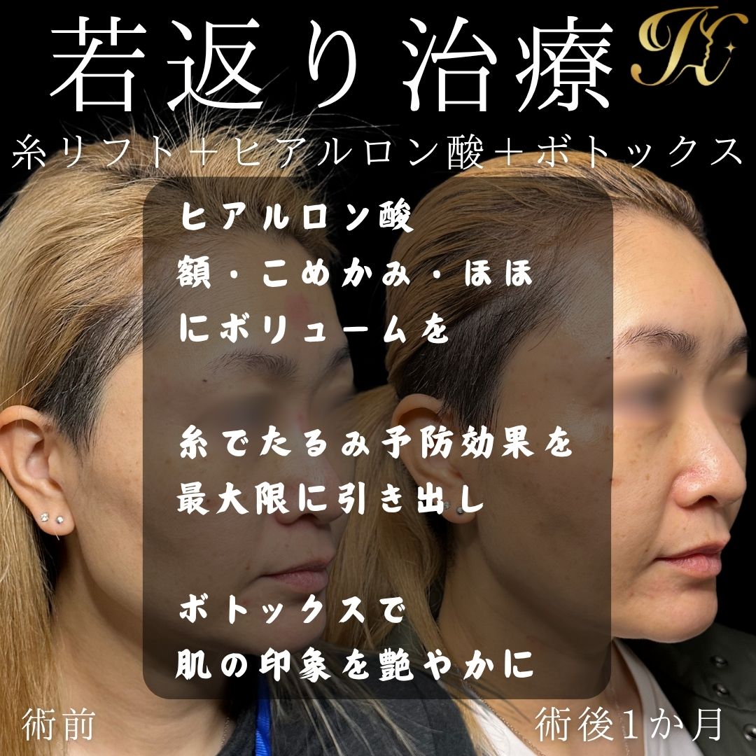 症例イメージ