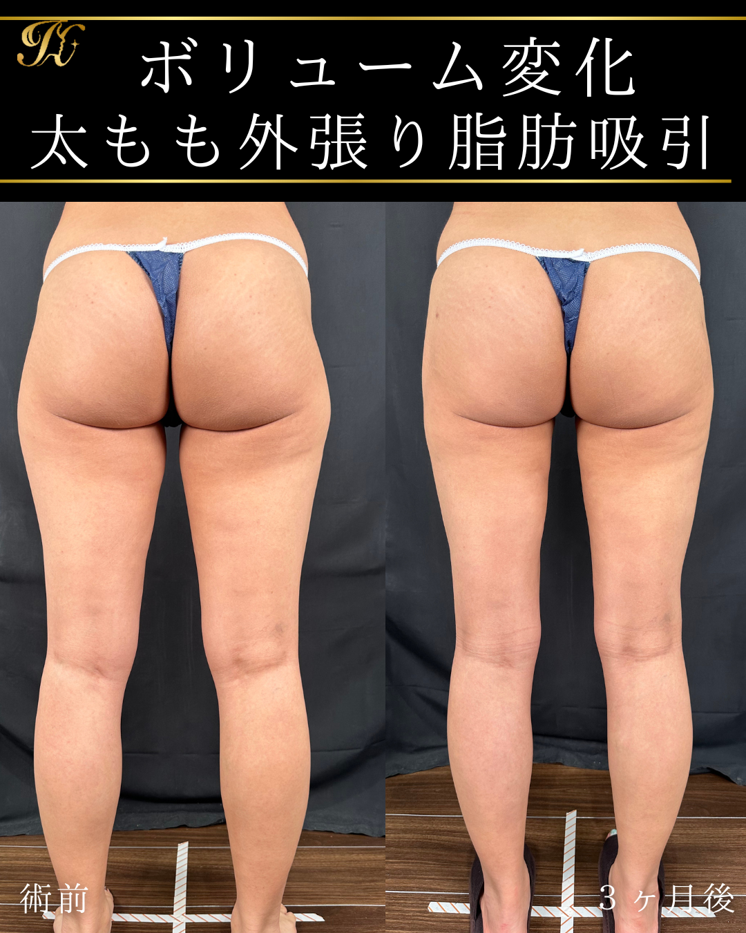 症例イメージ