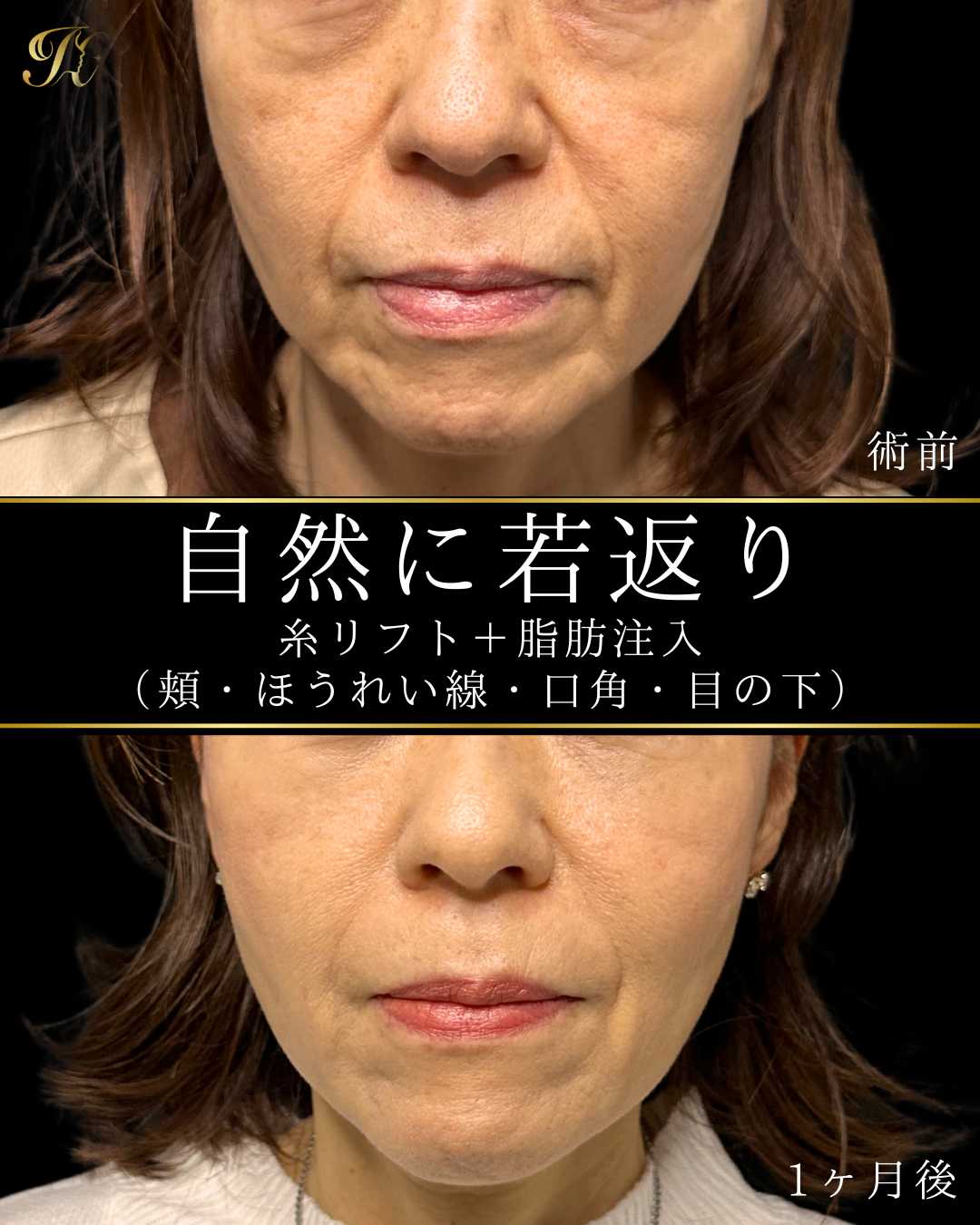 症例イメージ