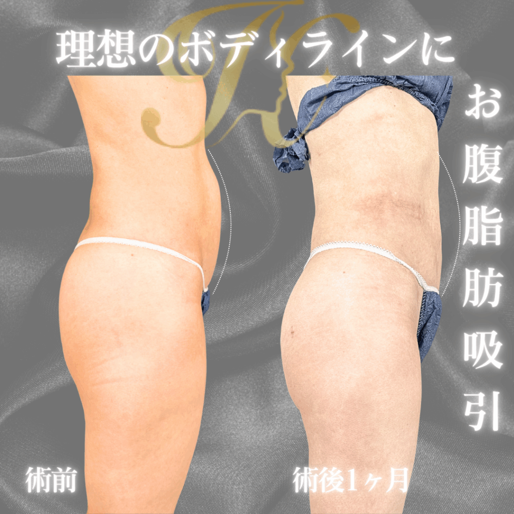 症例イメージ