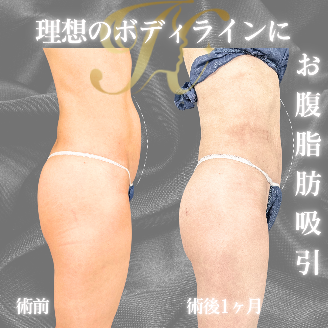 症例イメージ