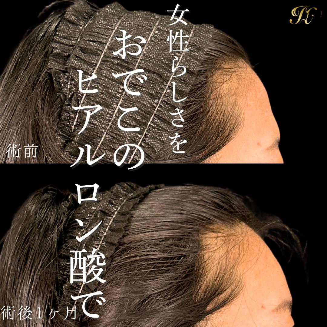 症例イメージ