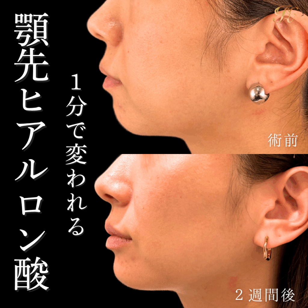 症例イメージ