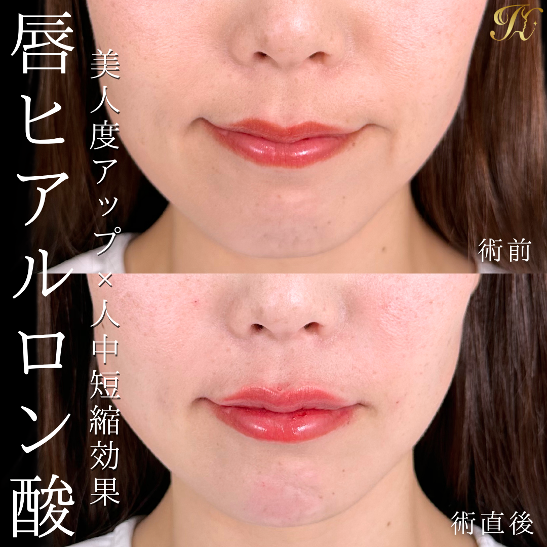 症例イメージ