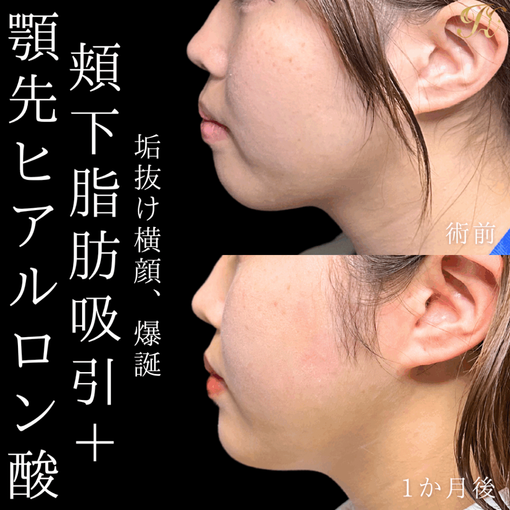 症例イメージ