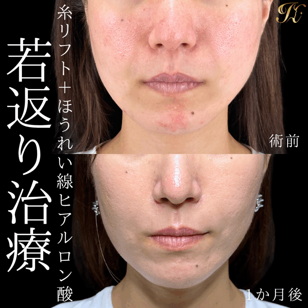 症例イメージ