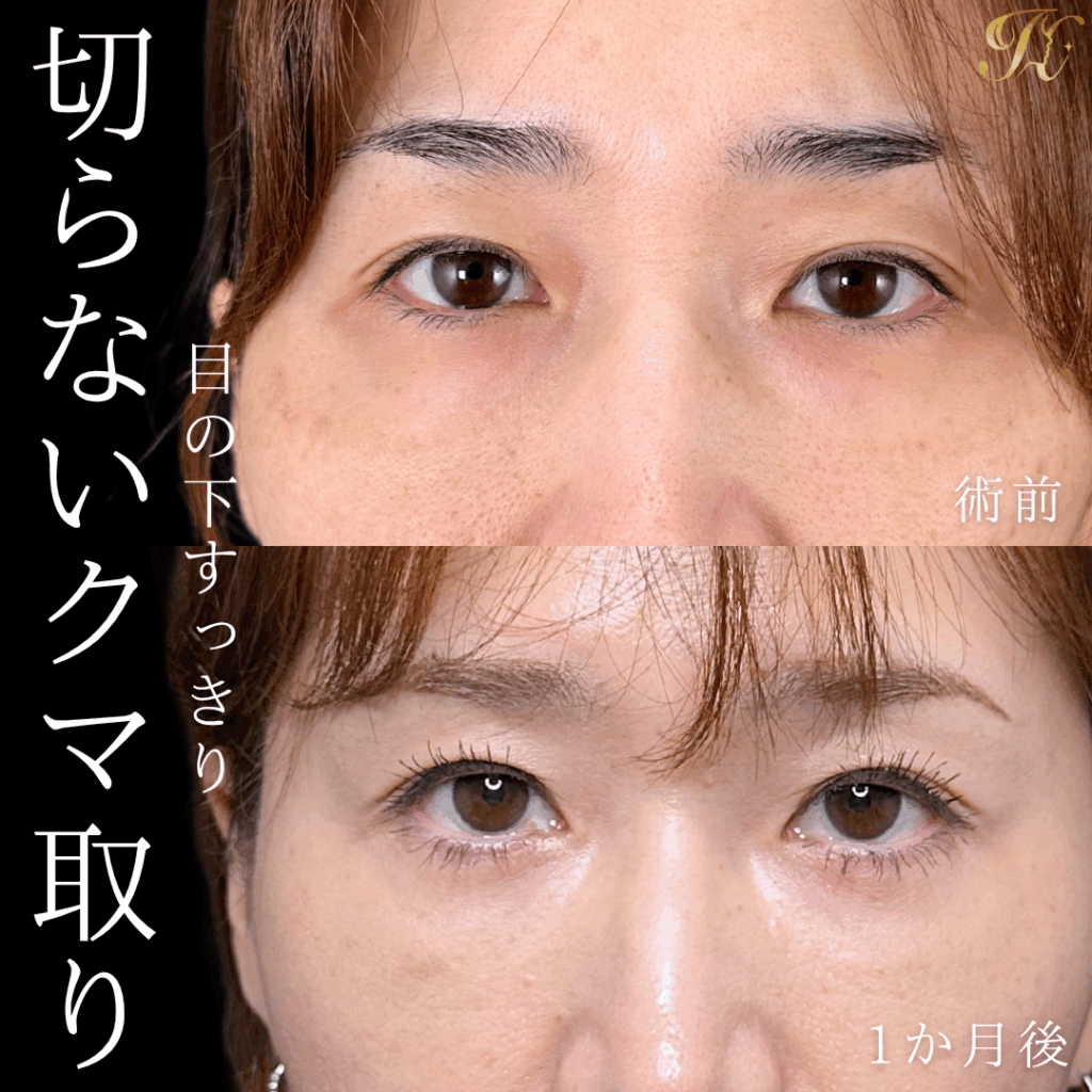 症例イメージ