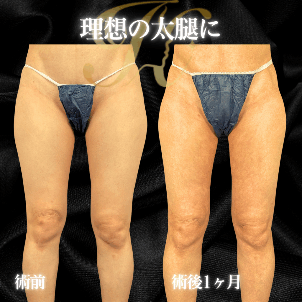 症例イメージ