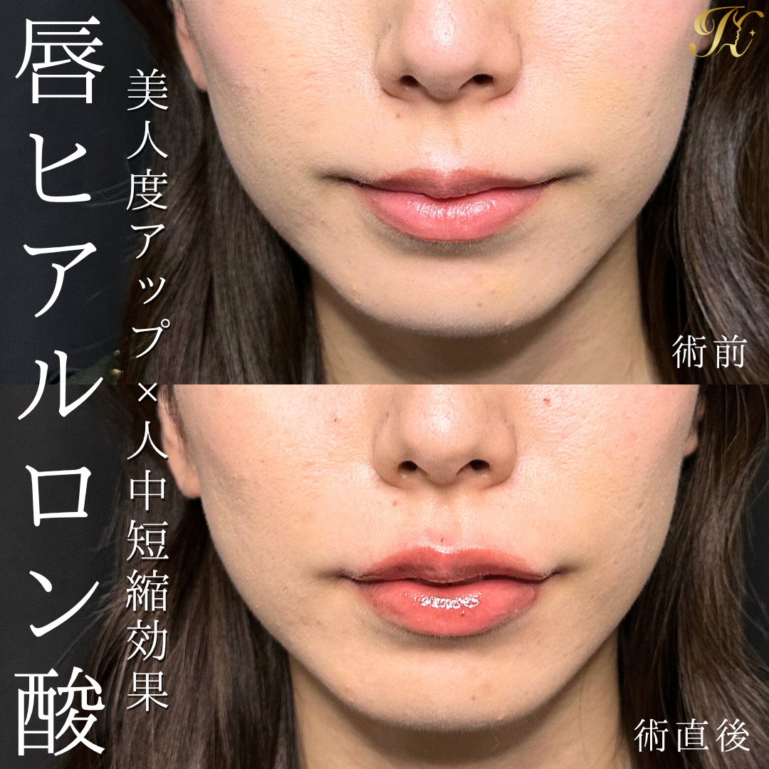 症例イメージ