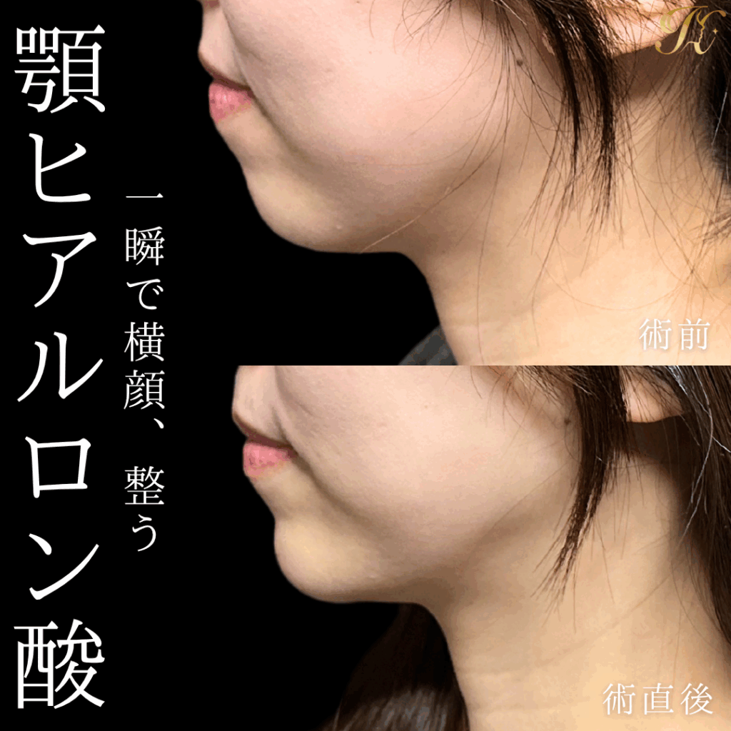 症例イメージ