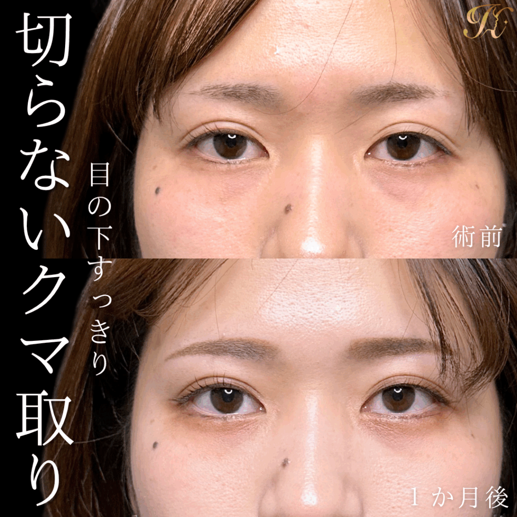 症例イメージ