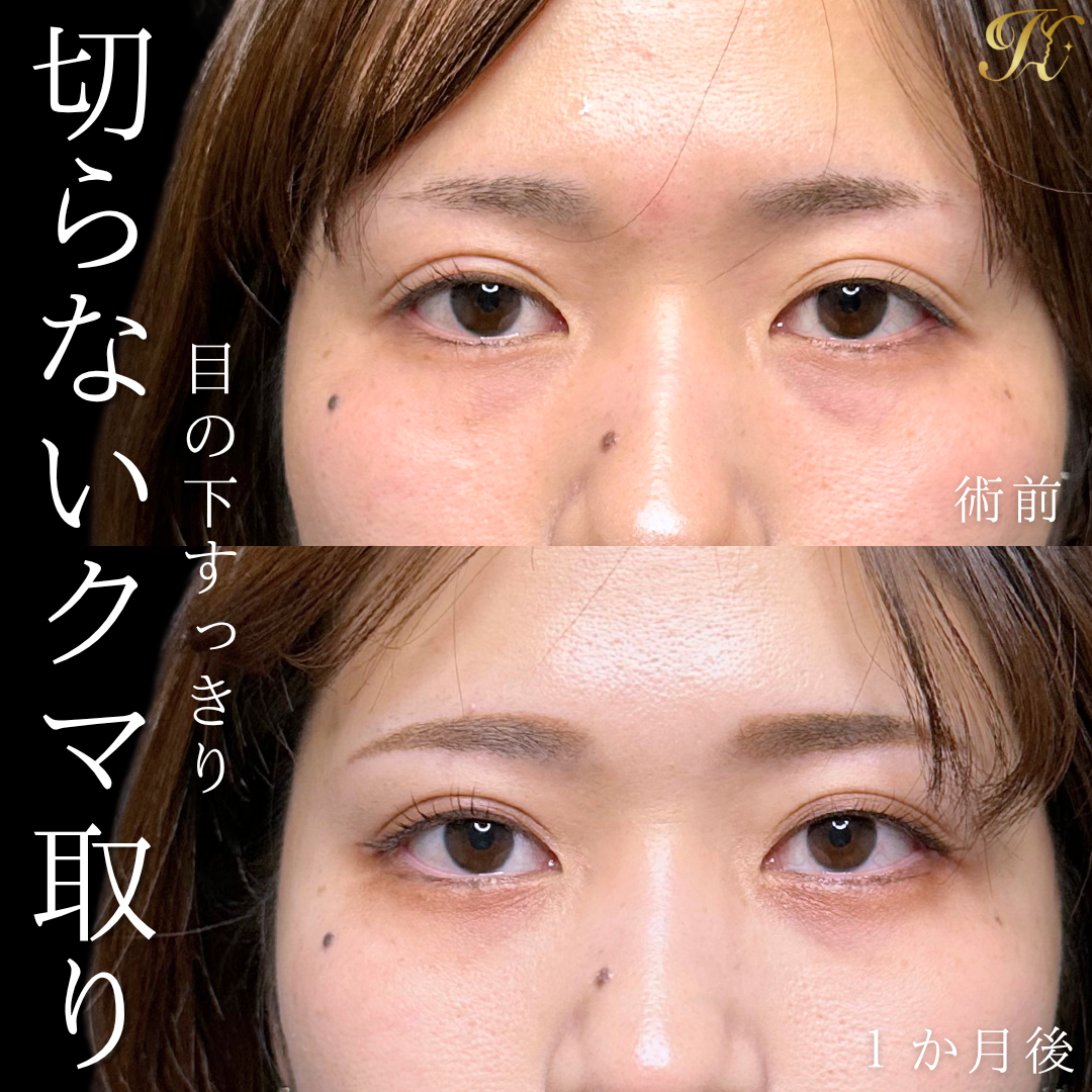 症例イメージ