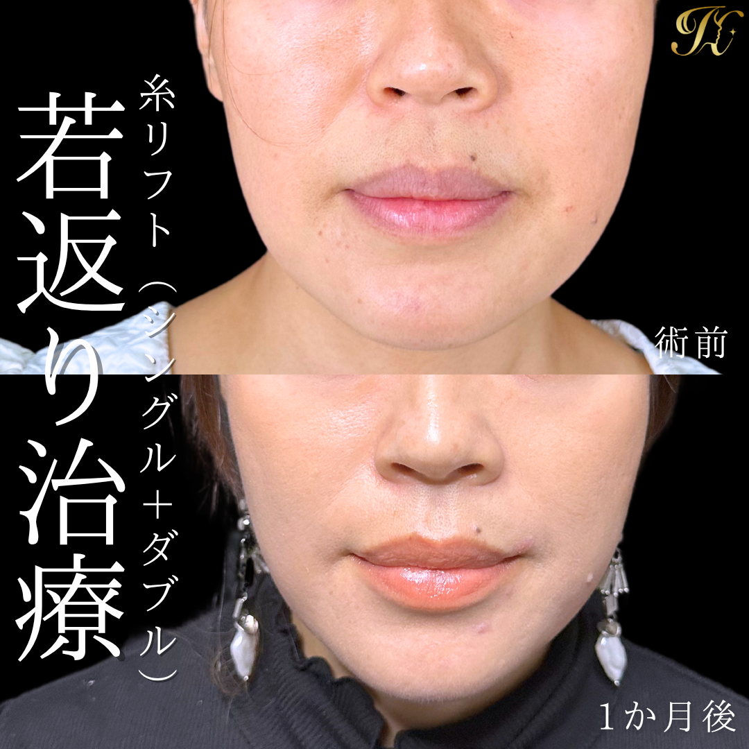 症例イメージ